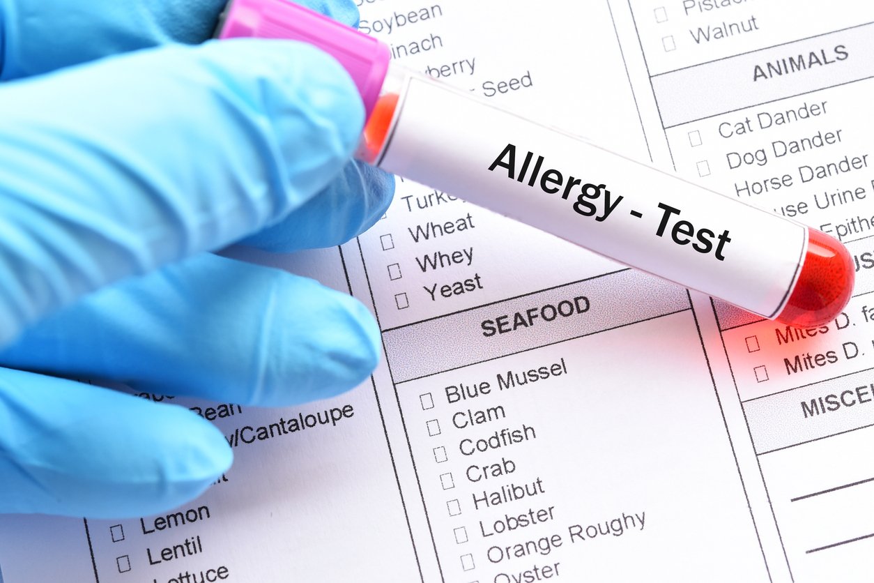 Understanding Food Allergy Testing and Treatment Options