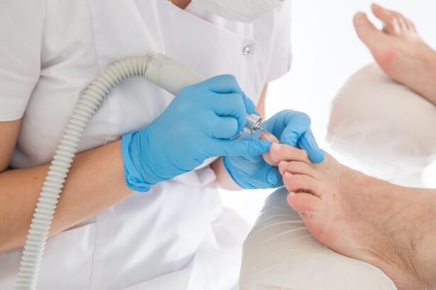 Exploring Remedies for Foot Fungus