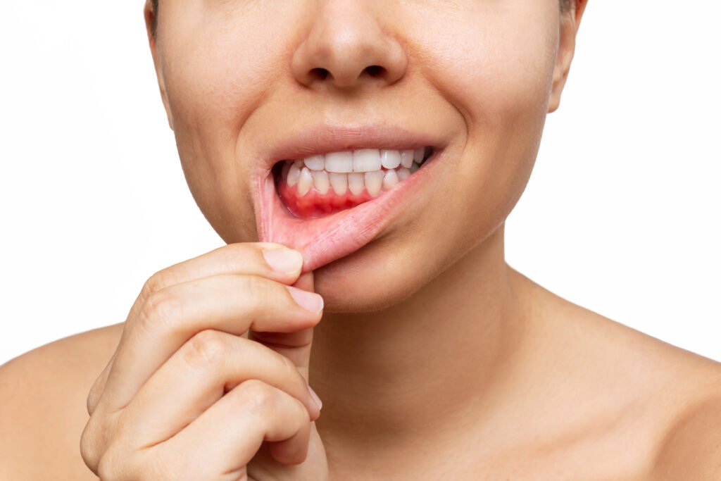 Understanding The Link Between Periodontal Disease And Systemic Health